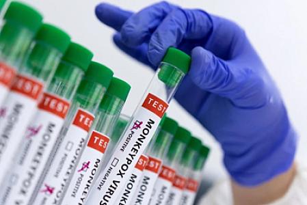 Daha bir ölkədə meymunçiçəyinə