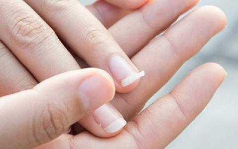 Dırnaqların qırılması hansı xəstəliyin
