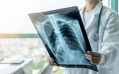 İnstitut direktoru hansı şəxslərin vərəmə meyilli olduğunu