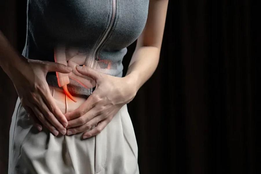 Appendisit əməliyyatından sonra