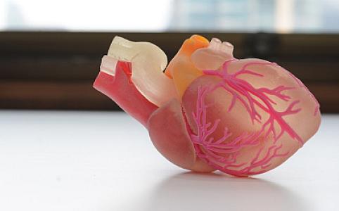 Bir qan testi qadında növbəti 30 il üçün infarkt və insult riskini