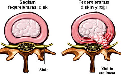 "Qrija" necə yaranır? -