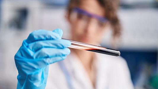 Alimlər qan xəstəliklərinin müalicəsində