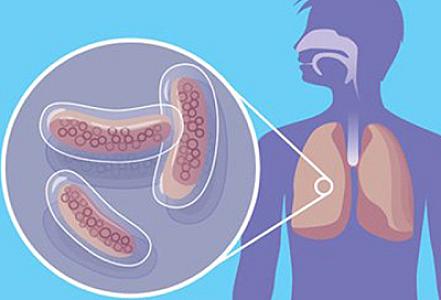 Vərəmə tutulmamaq üçün