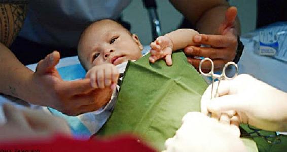 Sünnət əməliyyatı