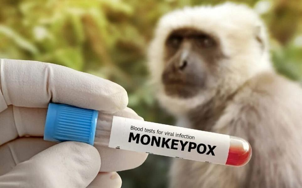 Meymunçiçəyi xəstəliyi ilə mübarizə üçün