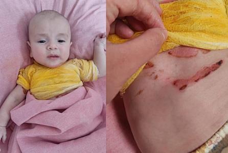 Bacısı üstünə qaynar su dağıdan Aminin