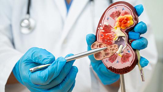 Koronavirus böyrək funksiyasını