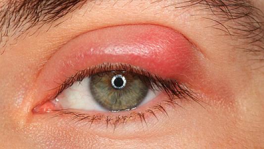 Gözünüzdən itdirsəyi çıxıbsa,