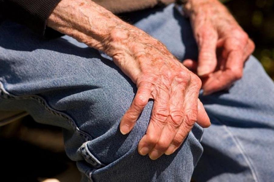 Parkinson xəstəliyi