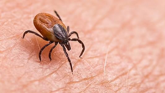 Zəngin insanların bu xəstəliyə yoluxma riski