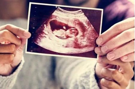 İranda 15 yaşlı qızların dünyaya uşaq gətirmələrinə