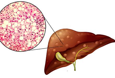 Qaraciyəri sağlam saxlamaq istəyənlər hər gün