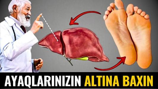 Qaraciyərin Öldüyünü Göstərən 9 Əlamət!