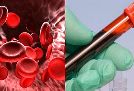 Qatı qanın səbəb olduğu