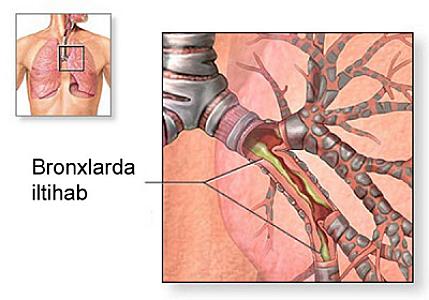 Nəfəs yollarını ən yaxşı təmizləyən