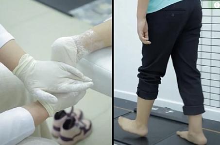 Yastıpəncəli kişilər hansı durumda