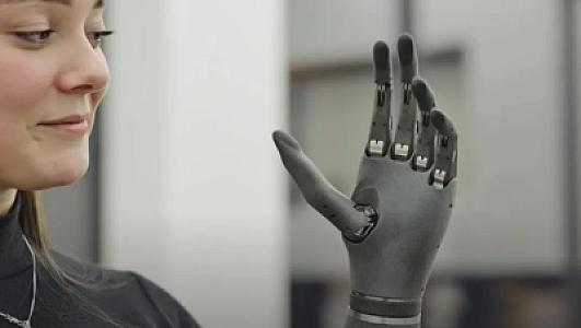 Protez əllər düşüncə gücü ilə hərəkət etdirildi -