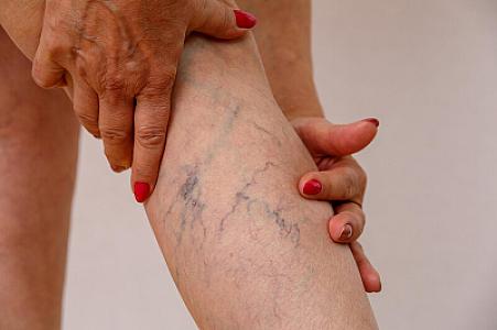 Bədəndə tromb hansı nayihələrdə yaranır?