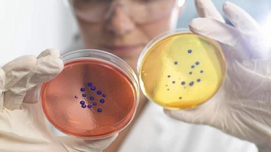 İnsanlar "ətyeyən bakteriya"ya görə əl-ayaqlarını itirirlər -