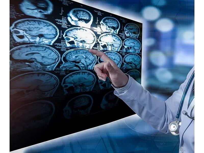 Alimlər açıqladı: İnsan beynini ölümdən qaytarmaq