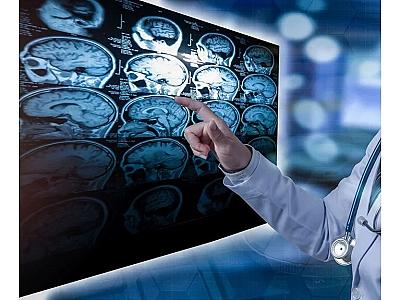 Alimlər açıqladı: İnsan beynini ölümdən qaytarmaq