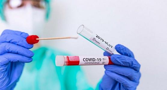 COP29-a gələn qonaqlardan koronavirus testi götürüləcək? -