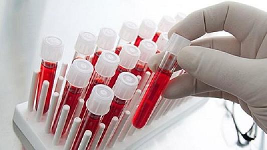 Bu qan qrupu olan insanlar daha çox yaşayır –