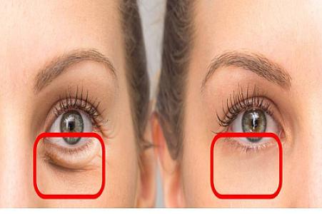 Bu su göz altındakı torbaları