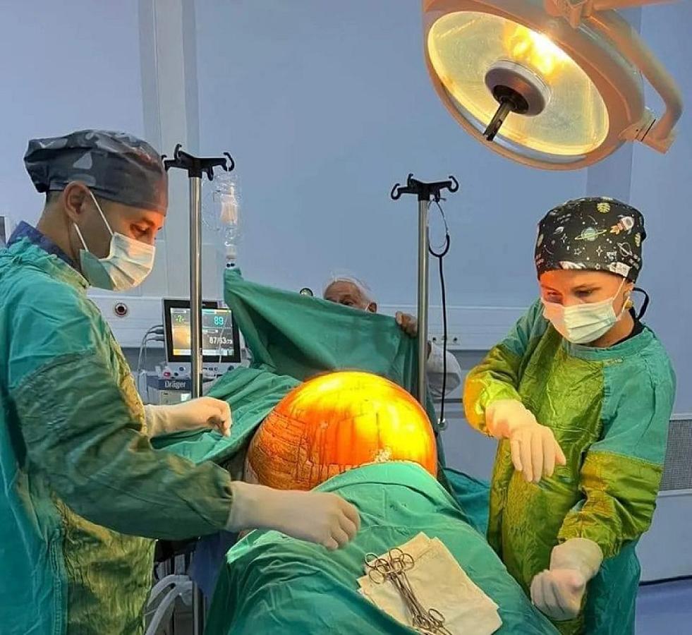 Azərbaycanda qadının qarnından 32 kq-lıq kista çıxarılıb - FOTOLAR