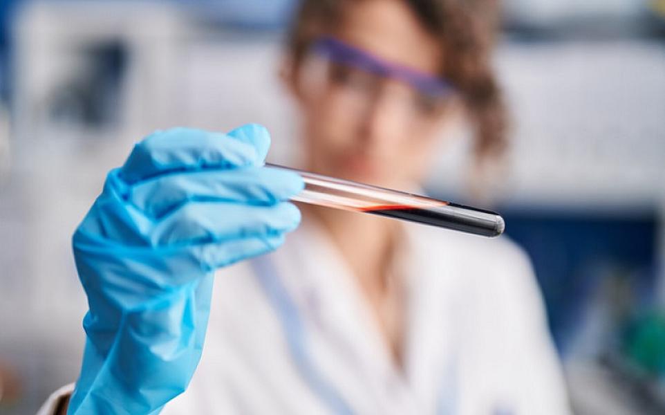 Alimlər qanı sümüklərin və digər bədən toxumalarının bərpası üçün