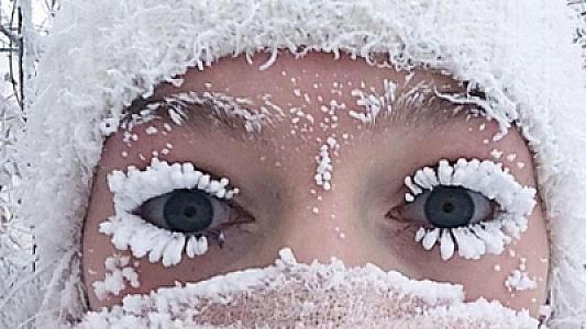 Dəyişkən havalarda səhhətimizi