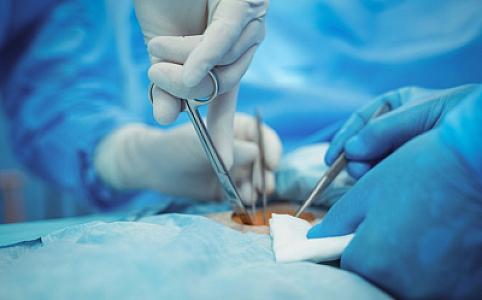 İcraçı direktor: "Stasionar cərrahi tibbi xidmətlərin 69 %-i TƏBİB-in müəssisələrində icra edilib"