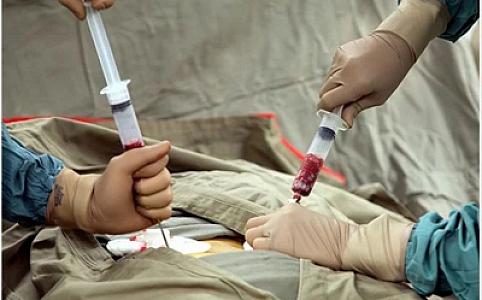 Orqan və sümük iliyinin köçürülməsi ilə bağlı təlimatlar xəstəxanalara göndərilib