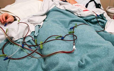 Sümük iliyi transplantasiyası cərrahi müdaxilə olmadan həyata keçiriləcək