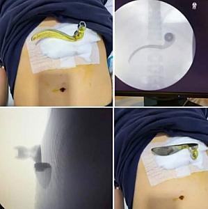 107 nömrəli məktəbdə bədbəxt hadisə: