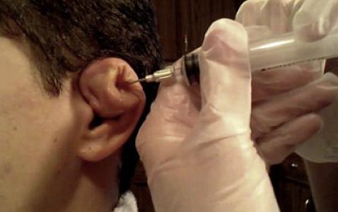 “Sol qulağı qırmaq daha bahadır,