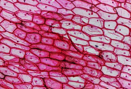 İmmun sistemi yaşlanmış hüceyrələri kənarlaşdıra bilər -