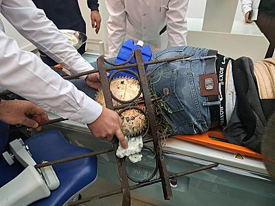 Qobustan sakini hasardan tullanarkən ciddi xəsarət alıb