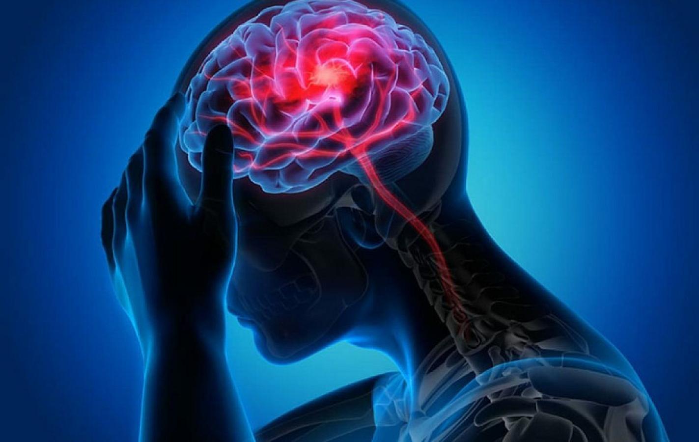 Epilepsiya beyin sağlamlığını görün necə