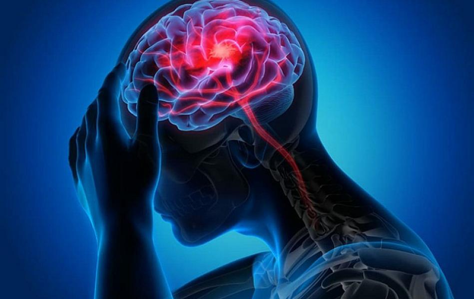 Epilepsiya beyin sağlamlığını görün necə