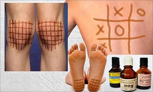 Yod kletkası bu xəstəliklərdə də