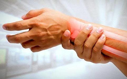 Sümükləri pendir kimi əridir!