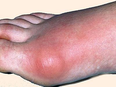 Podaqranın müayinə və stasionar müalicəsi icbari tibbi sığorta ilə qarşılanır? -