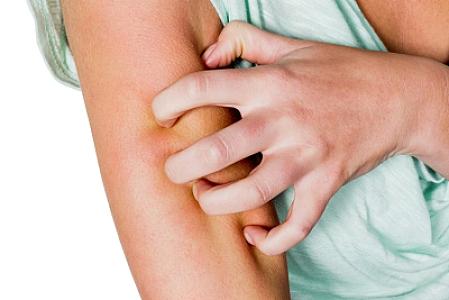 Həşərat dişləmələrinin yerlərini qaşımaq faydalı imiş -