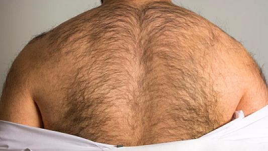 Az tüklü kişilərdə testosteron səviyyəsi