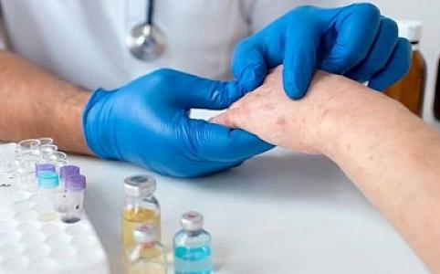 Azərbaycanda qızılcaya yoluxma halları artır - RƏSMİ