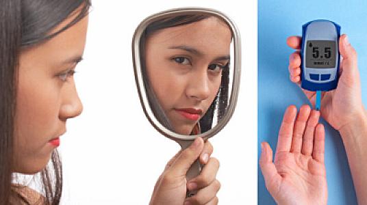 Üzünüz şəkər xəstəliyinin xəbərçisi ola bilər: