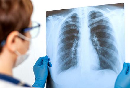 Pnevmoniyadan tam sağalma mümkündür? -