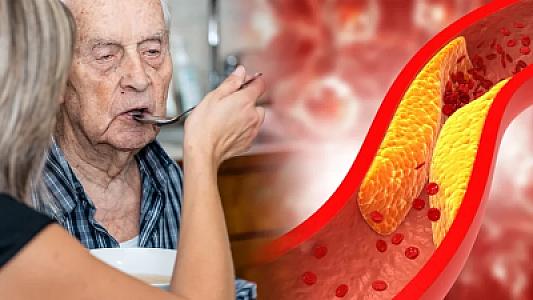 Xolesterolun əzəli düşmənidir: Bir çimdik yeyin,